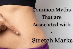 Common Myths That are Associated with Stretch Marks