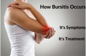 How Bursitis Occurs, It’s Symptoms and It’s Treatment
