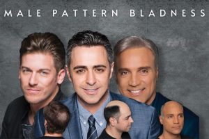 Reasons For Getting Bald and What is Male Pattern Baldness